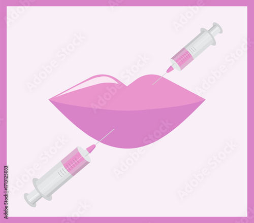 Women's lips and syringes with filler, cosmetic procedure, beauty injection in the lips, syringe, beauty injections, lip augmentation
