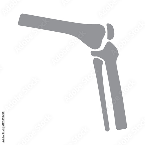 Elbow Joint Illustration
