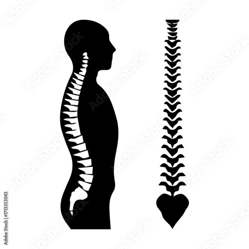 Spine Diagram