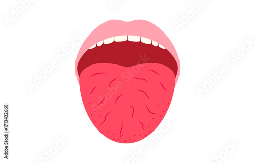 Xerostomia or dry mouth