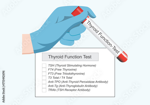 Thyroid function blood test is used to check thyroid stimulating hormone.