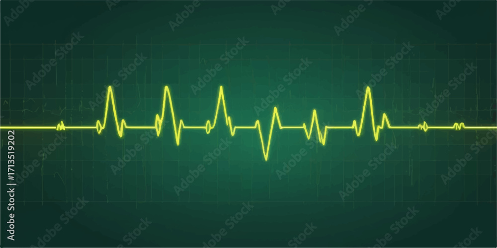 Obraz premium Green heartbeat line on a monitor representing EKG pulse and heart rate for medical health and life illustration