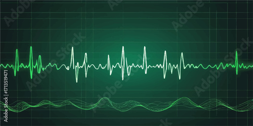 Green ECG heartbeat pulse line on a medical monitor screen