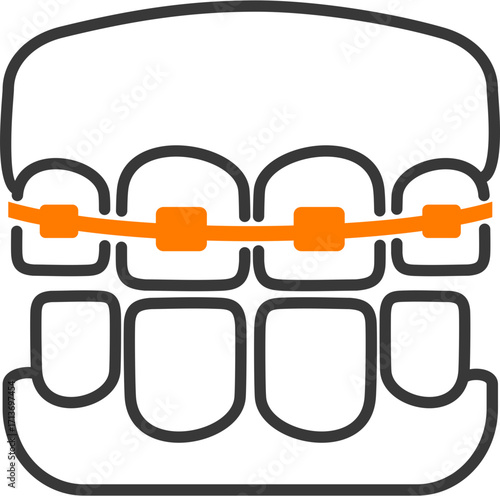 Teeth braces

