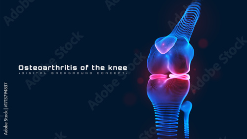 Knee Joint Osteoarthritis Pain Background, Futuristic Medical Interface Scan Design Concept, Blue Particle Neon Glow Technology Scene. Vector illustration.