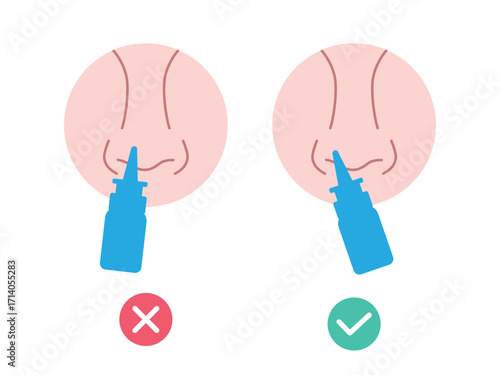Proper use of a nasal spray