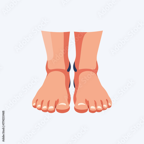 Illustration of two bare feet, viewed from the front, with toes visible against a light background.