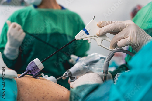 gastric sleeve surgery performing by surgeon	