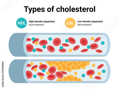Type of cholesterol in human blood vessels. Low-Density Lipoprotein LDL . High-Density Lipoprotein HDL. Medical Vector illustration