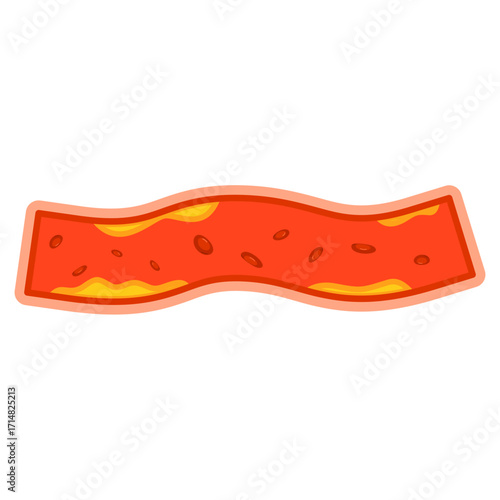 Illustration of Cholesterol in Blood