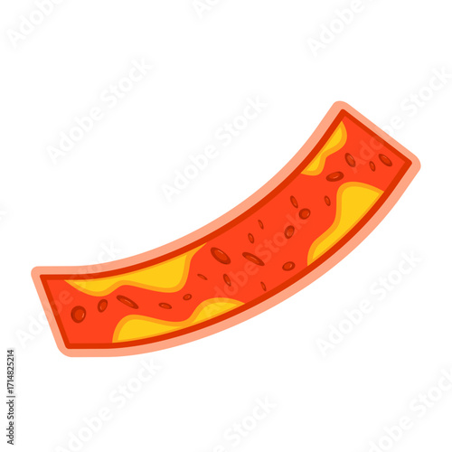 Illustration of Cholesterol in Blood
