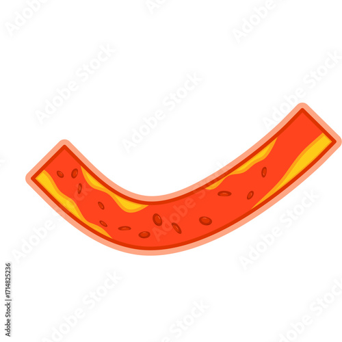 Illustration of Cholesterol in Blood