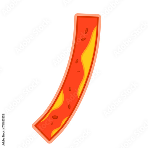 Illustration of Cholesterol in Blood