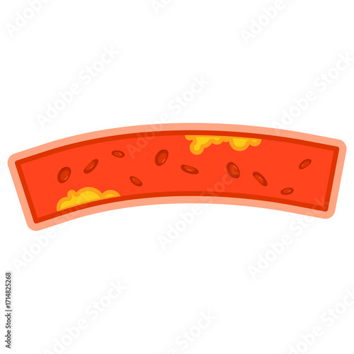 Illustration of Cholesterol in Blood