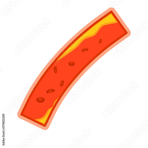 Illustration of Cholesterol in Blood