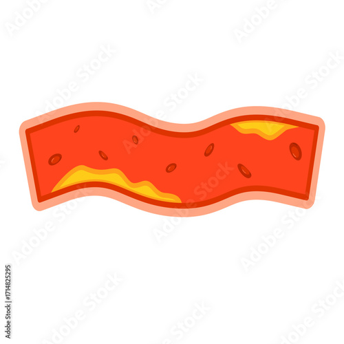 Illustration of Cholesterol in Blood