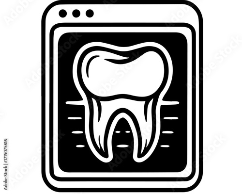 Digital Dental X-ray Illustration with Tooth Anatomy on Monitor Screen