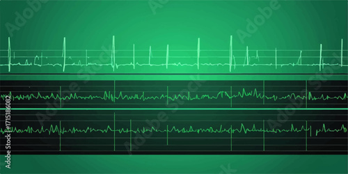 Digital technology illustration of a heartbeat line on a blue monitor displaying EKG data for medical business design