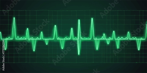 EKG heartbeat on a blue medical monitor graph shows the steady pulse line of a healthy heart