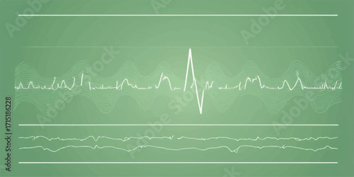 A vibrant green cardiogram line forms a heart shape on a medical monitor, depicting a vital heartbeat and pulse wave
