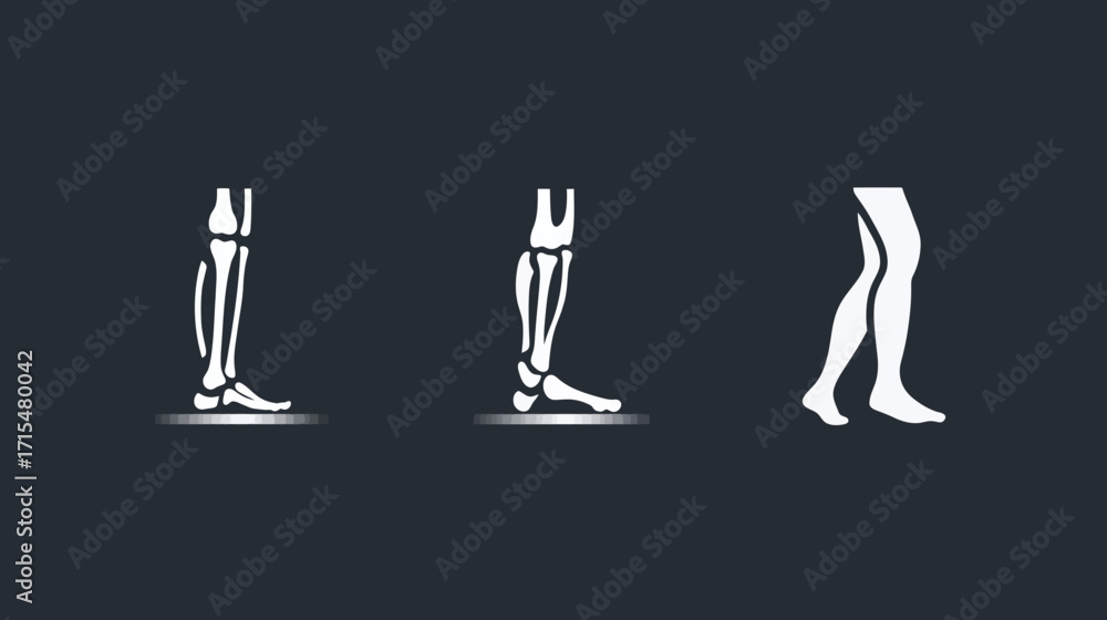 Fototapeta premium Human Leg Bone Structure Variations.