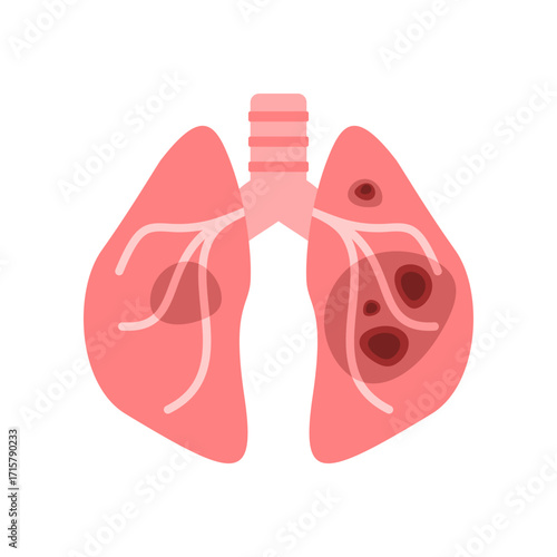 Lung disease medical icon flat vector design