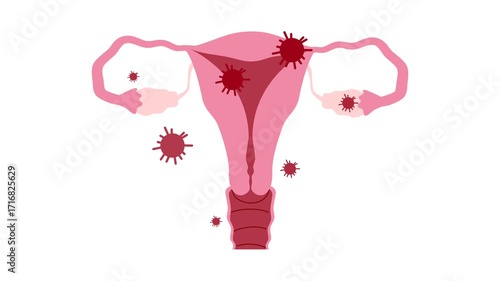 Ovarian cancer illustration. World ovarian cancer day concept	