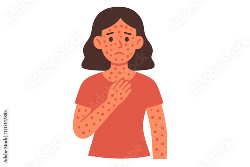 Woman infected with monkeypox showing blisters on skin, monkeypox virus symptoms, sick female person vector illustration, flat human character portrait, viral infection disease concept