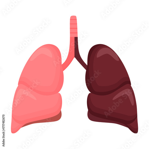 Illustration of healthy human lungs and dark infected dirty lungs damaged by smoking, pollution, or respiratory disease for medical education, healthcare poster, and infographic