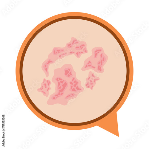Dermantitis Illustration Element. Illustration of a hand affected by allergies. Flat design illustration of a sick hand. Illustration of a hand with red bumps due to allergie