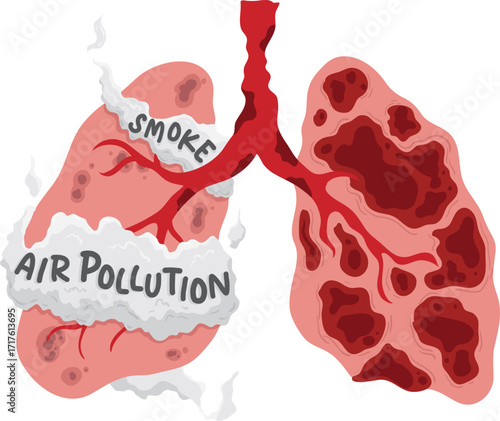 Lungs Damaged by Smoke and Air Pollution