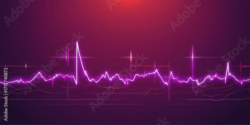 A medical ECG cardiogram showing a green heartbeat wave on a monitor