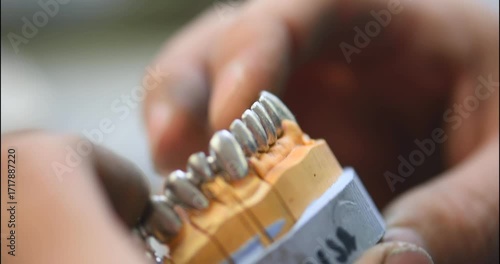 Dental prosthesis, dentures, prosthetics work. A study and a table with dental tools