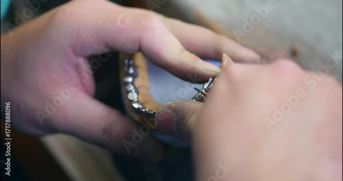 Dental prosthesis, dentures, prosthetics work. A study and a table with dental tools
