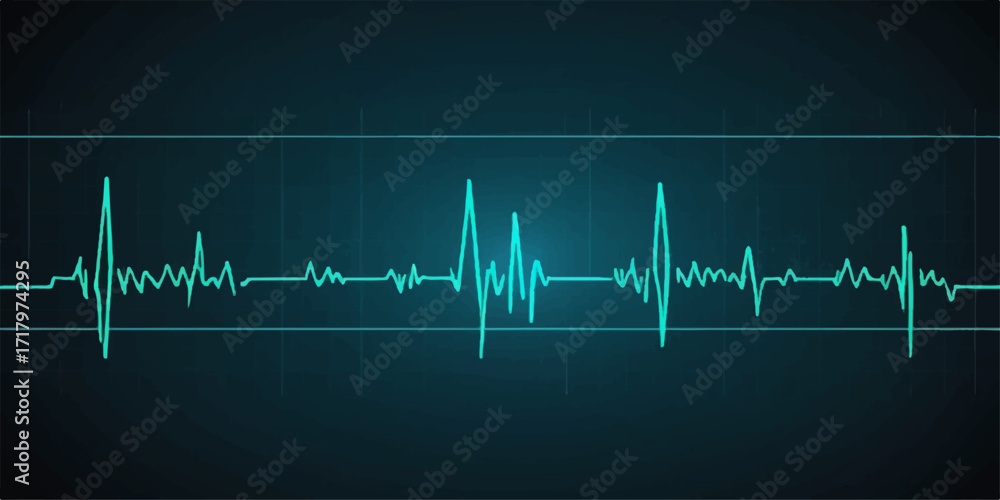 Ταπετσαρία Green cardiogram line on the EKG monitor showing a healthy heartbeat