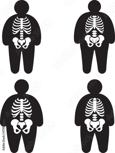 Four identical black silhouettes of overweight figures with visible white skeletons inside silhouette