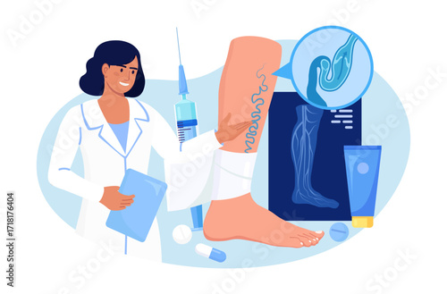 Vein Thrombosis and Varicose Treatment. Surgeon treat vascular diseases, apply tight bandage. Doctor near Big Foot with Diseased Veins. Doppler ultrasonography of the lower extremity arteries