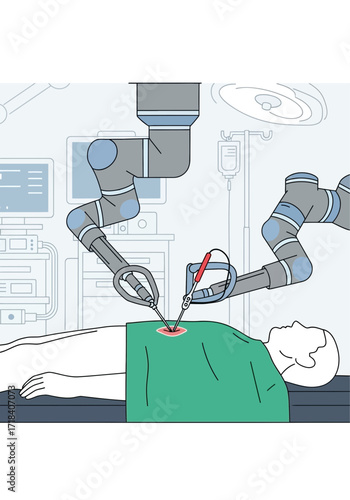 Flat Vector Illustration of Robotic Surgery on Patient