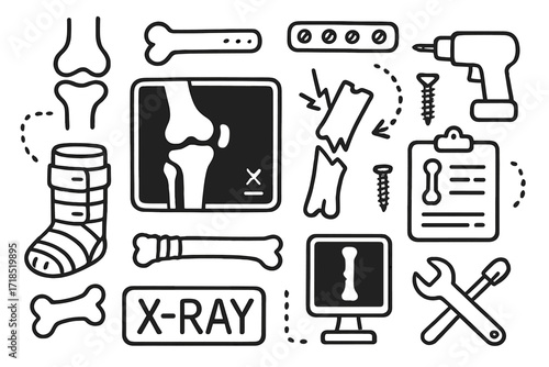 Orthopedic X-ray Tools. Hand-drawn doodle illustration Orthopedic X-ray tools joint icon, bone plate, screw, scan image, fracture mark, X-ray film, cast,