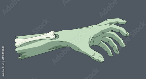 Decaying Hand Illustration A Graphic Reminder of Mortality