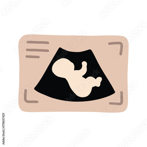 Ultrasound scan of a baby in the womb.