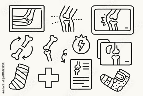 Joint X-Ray Doodle. Hand-drawn doodle illustration Joint X-ray elbow, knee, wrist, ankle, bone segments, X-ray image, rotation