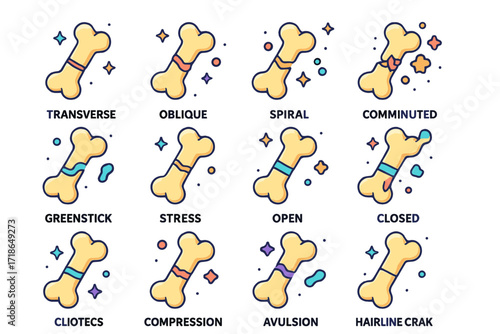 Bone Fracture Icons. Colorful isometric vector icons set of types of bone fractures: transverse fracture, oblique fracture, spiral