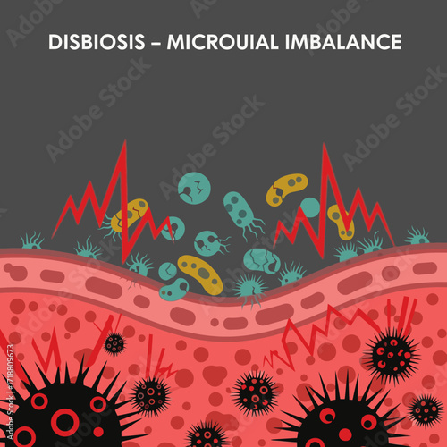 Microbial imbalance illustration showcasing dysbiosis and gut health issues, perfect for healthcare and wellness marketing materials needing a visual punch