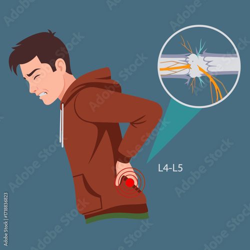 Experiencing intense lower back pain, possibly a herniated disc at L4-L5, visualized with nerve damage for educational health content