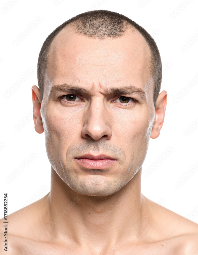 Obraz premium Closeup of a Bald Man with a Serious Expression.