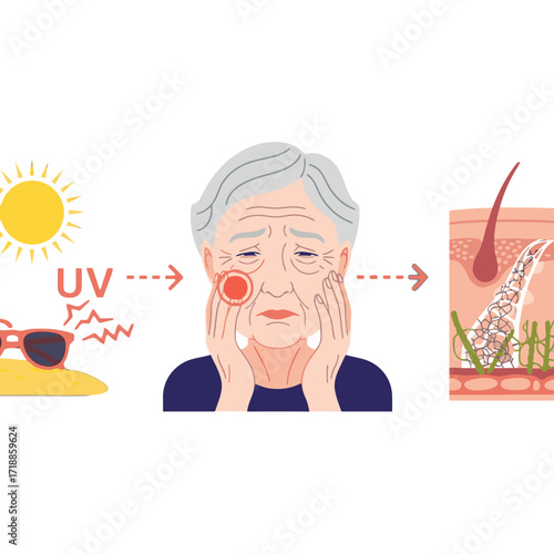 Protecting aging skin from sun damage with daily sunscreen for a healthy complexion and preventing wrinkles, sunburn and skin cancer for years to come