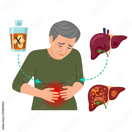 Alcohol consumption linked to liver disease illustration showing man with stomach pain and damaged livers, conveying health risk awareness