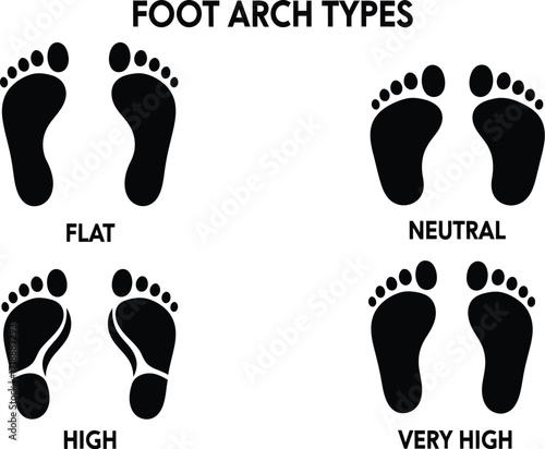 Foot arch types illustration flat neutral high very high