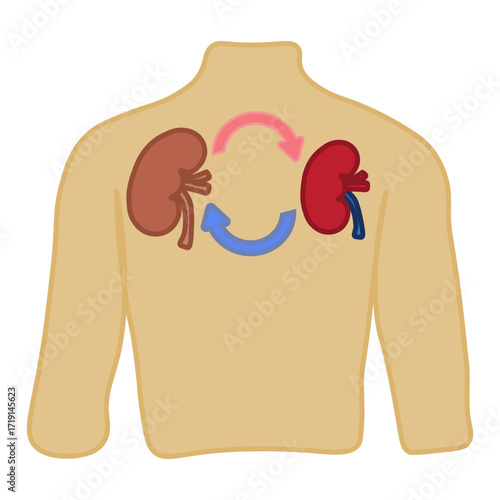 kidney transplant 
